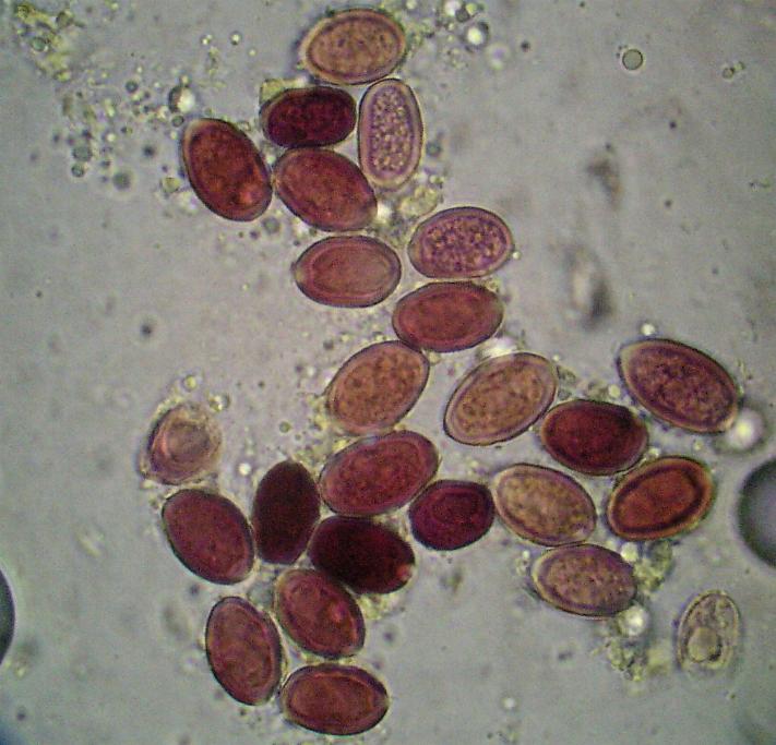 Macrolepiota sp. (cfr. Macrolepiota mastoidea)
